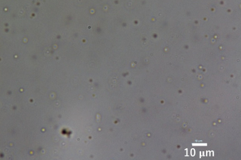 FUSの液滴形成の高圧顕微鏡写真