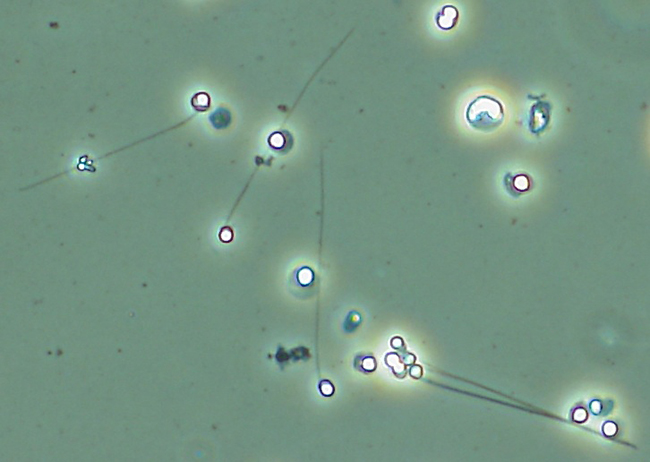 培養で形成された精子