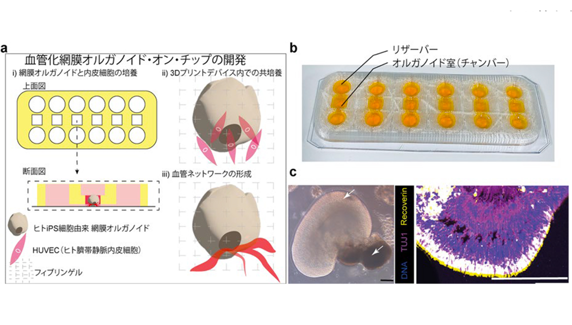 血管を備えた「ミニ網膜」を、完全 3D プリント製チップ上で再現