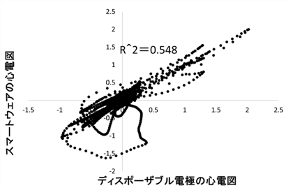 スマートウェアの心電図